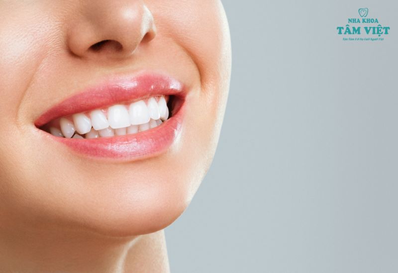 Răng sứ DDBio có tốt không? Ưu nhược điểm của DDBiO 2 Răng sứ DDBio nổi bật với độ bền