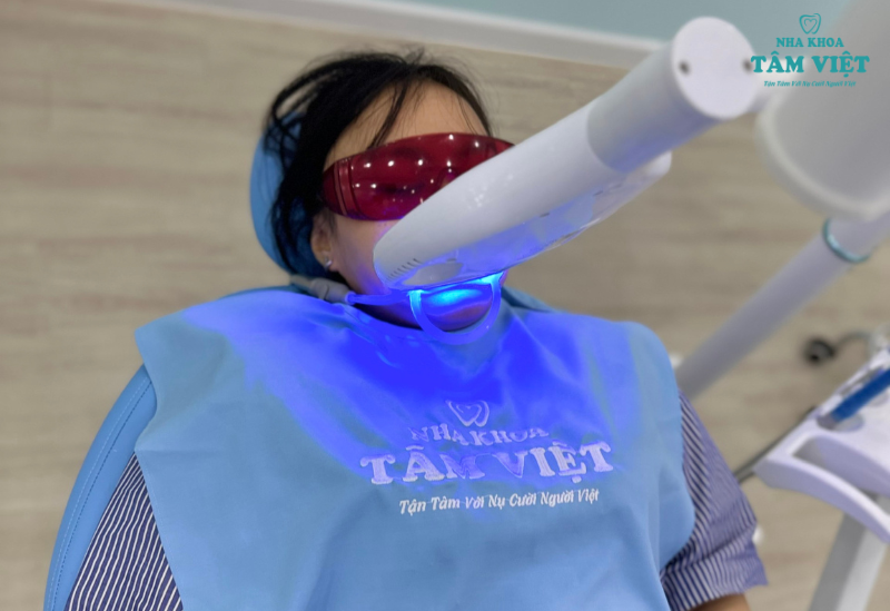 Công nghệ tẩy trắng răng bằng ánh sáng laser