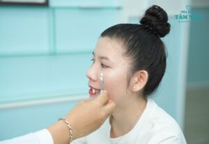 Chi phí tẩy trắng răng