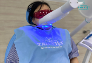 Sau khi tẩy trắng răng kiêng gì? Thời gian kiêng ăn bao lâu?