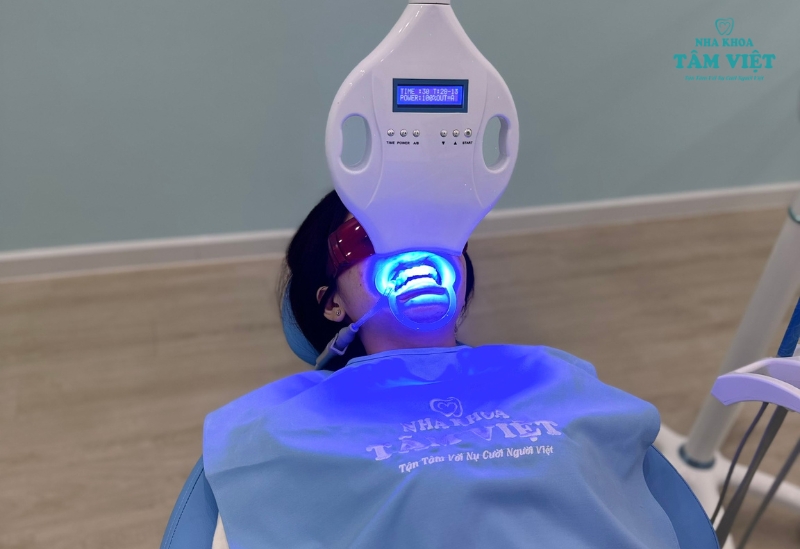 Có nên tẩy trắng răng ở nha khoa hay không? 6 Tẩy trắng răng bằng đèn Plasma tại Nha khoa Tâm Việt