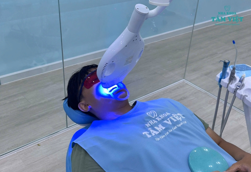 Tẩy trắng răng có hại không? Làm thế nào để an toàn? 3 Tẩy trắng răng bằng đèn plasma