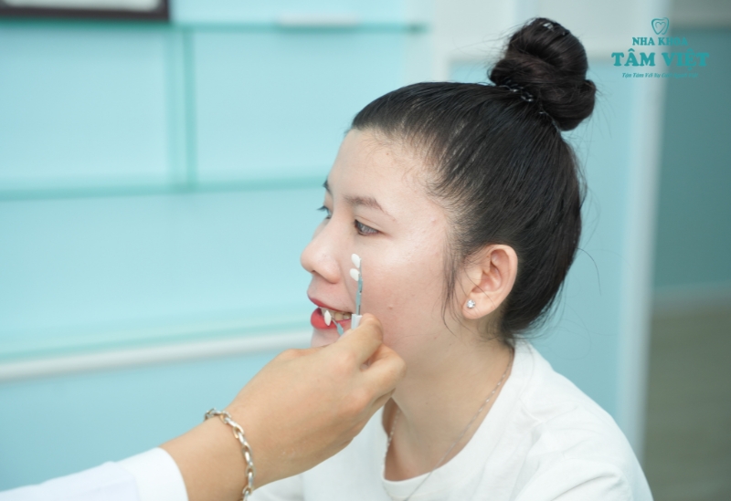 Tẩy trắng răng có hại không? Làm thế nào để an toàn? 5 Thăm khám kỹ lưỡng trước khi thực hiện tẩy trắc răng