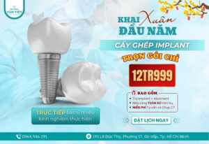 Ưu đãi sốc đầu năm - 50 suất cấy ghép implant trọn gói chỉ 12tr999k!