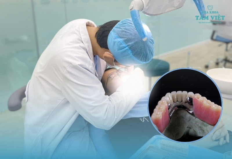 Chi phí làm răng giả tháo lắp bao nhiêu tại TPHCM?