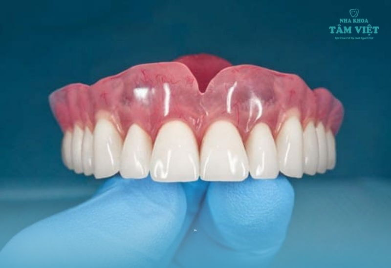 Chi phí làm răng giả tháo lắp bao nhiêu tại TPHCM? 2 Răng giả tháo lắp là gì?