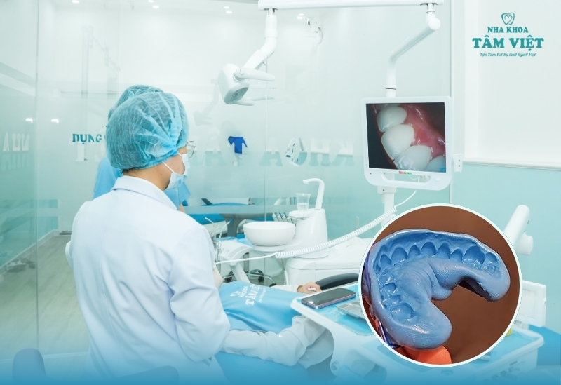 Công nghệ cấy ghép Implant hiện đại có gì đặc biệt? 3 Công nghệ CAD/CAM