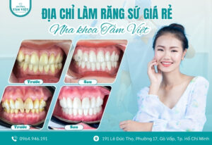 Tìm địa chỉ làm răng sứ giá rẻ, bền đẹp ở đâu?