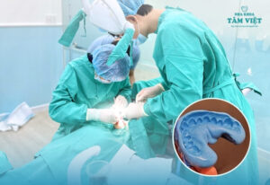 Lấy dấu implant quan trọng thế nào trong cấy ghép răng?