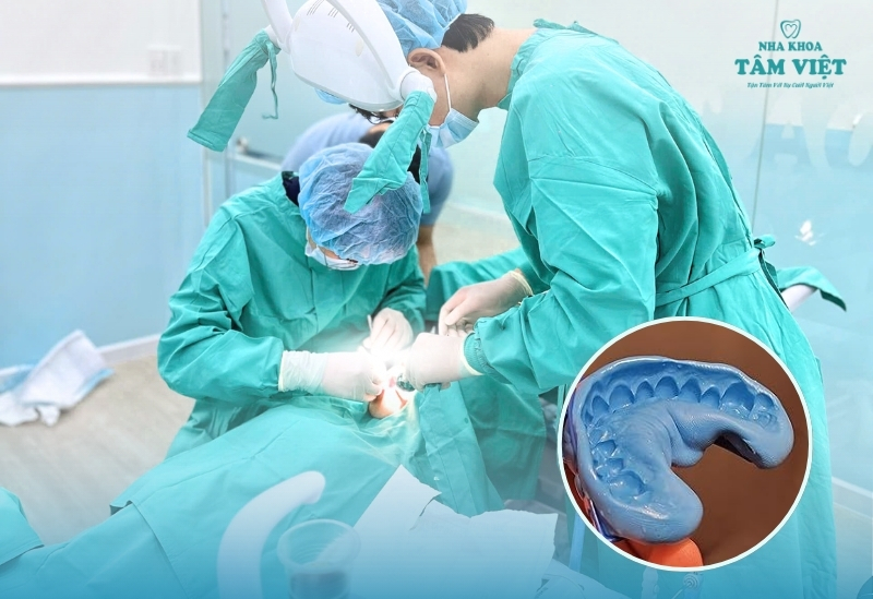 Lấy dấu implant quan trọng thế nào trong cấy ghép răng?