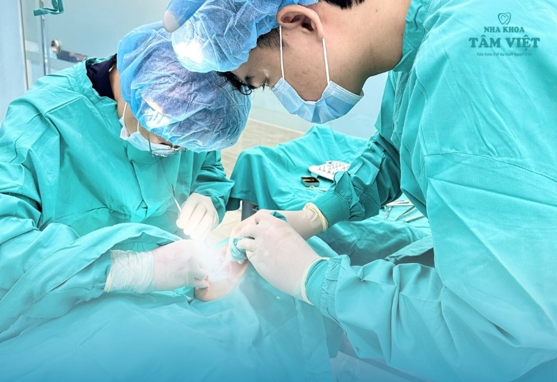 Chi tiết quy trình cắm răng implant từ A-Z bạn cần biết 4 Phẫu thuật đặt trụ Implant