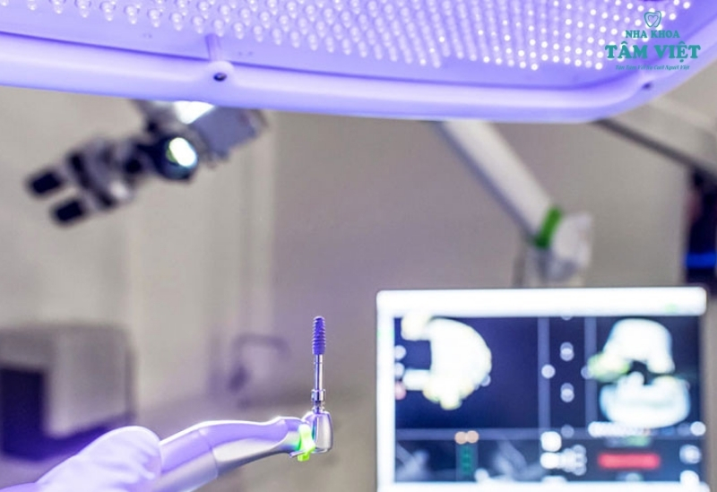 Trồng răng implant giá rẻ có tốt không? Chuyên gia giải đáp