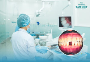 Giải pháp trồng răng sứ không có chân răng đẹp tự nhiên