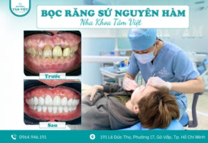Bọc răng sứ nguyên hàm giá bao nhiêu? Bảng giá chi tiết