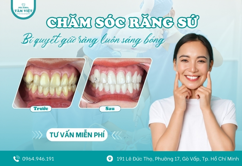 Bí quyết chăm sóc răng sứ thẩm mỹ để duy trì vẻ đẹp lâu dài