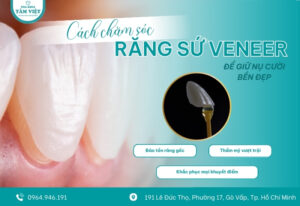7 lưu ý khi chăm sóc răng sứ veneer để giữ bền đẹp