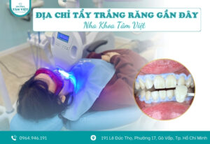 Địa chỉ tẩy trắng răng gần đây được nhiều người tin chọn