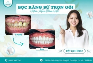 Cập nhật bảng giá bọc răng sứ trọn gói mới nhất tại nha khoa