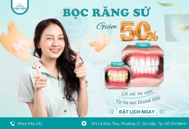 Cập nhật bảng giá bọc răng sứ trọn gói mới nhất tại nha khoa 5 Ưu đãi chào đón đại lễ tại Tâm Việt