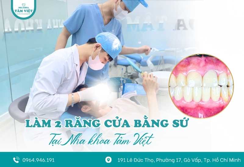 Làm 2 răng cửa bằng sứ ở đâu tốt tại Gò Vấp?