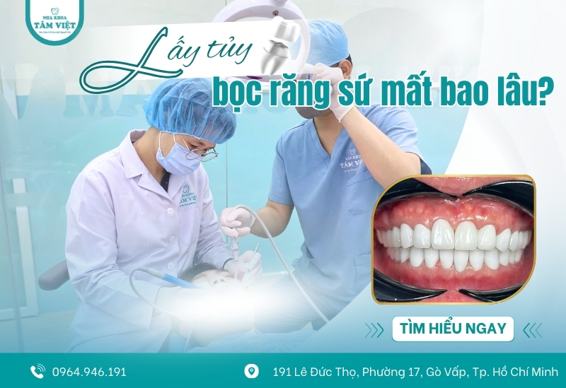 Lấy tủy bọc răng sứ mất bao lâu? Tìm hiểu ngay