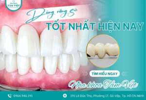 Dòng răng sứ nào tốt nhất hiện nay? Giá bao nhiêu?
