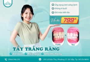 Tẩy trắng răng 799K – Ưu đãi chớp nhoáng dịp 30/4 – 1/5
