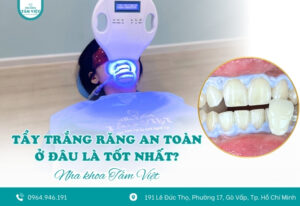 Răng xỉn màu? Tẩy trắng răng an toàn ở đâu là tốt nhất?
