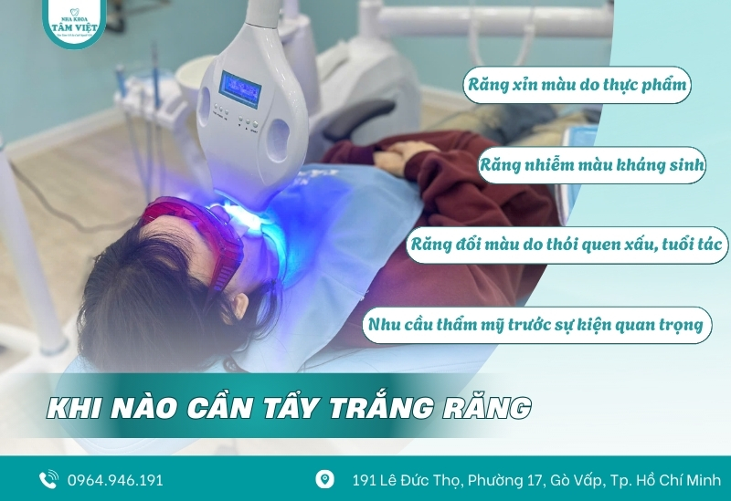 Răng xỉn màu? Tẩy trắng răng an toàn ở đâu là tốt nhất? 2 Khi nào cần tẩy trắng răng?
