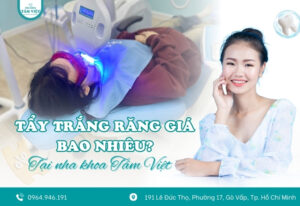Tẩy trắng răng giá bao nhiêu? Bảng giá mới nhất 2025