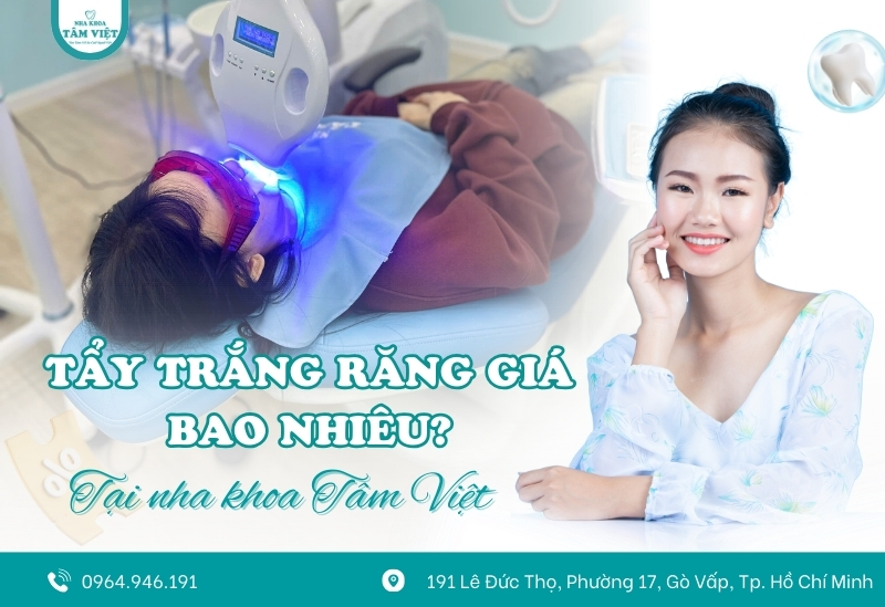 Tẩy trắng răng giá rẻ Gò Vấp ở đâu an toàn, hiệu quả? 2 Chi phí tẩy trắng răng bao nhiêu tiền?