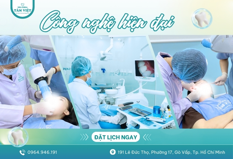 Bọc răng sứ ở đâu đẹp với 5 tiêu chí bạn cần biết 3 Công nghệ hiện đại