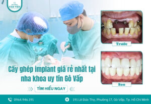 Cấy ghép implant giá rẻ nhất tại nha khoa uy tín Gò Vấp