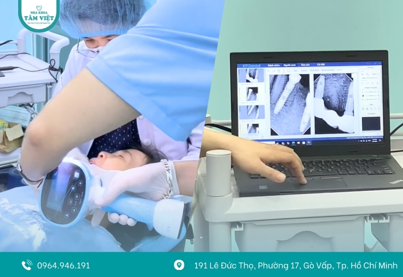 Cấy ghép implant giá rẻ nhất tại nha khoa uy tín Gò Vấp 3 So sánh giá giữa các nha khoa trồng implant uy tín