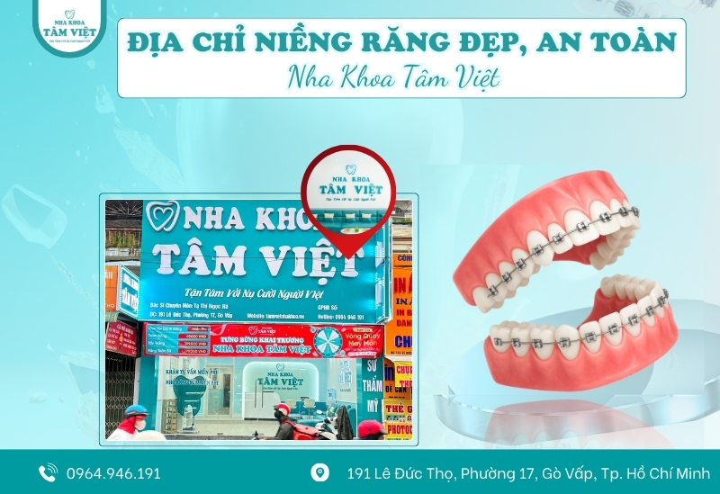 Đâu là địa chỉ niềng răng đẹp và an toàn tại TPHCM?