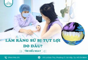 Làm răng sứ bị tụt lợi do đâu? Phòng tránh ra sao?