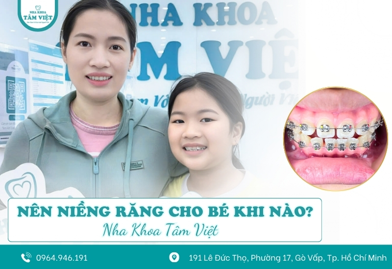 Nên niềng răng cho bé khi nào là hợp lý? Giải đáp từ bác sĩ