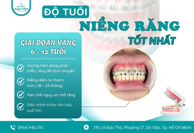 Độ tuổi niềng răng tốt nhất