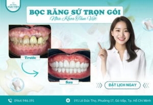 Tìm nha khoa bọc răng sứ đẹp, an toàn, chất lượng tại Gò Vấp