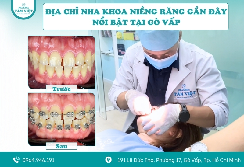 Địa chỉ nha khoa niềng răng gần đây nổi bật tại Gò Vấp