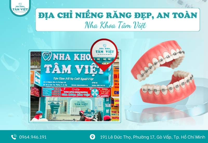 Địa chỉ nha khoa niềng răng gần đây nổi bật tại Gò Vấp 2 Địa chỉ nha khoa niềng răng gần đây nổi bật tại Gò Vấp
