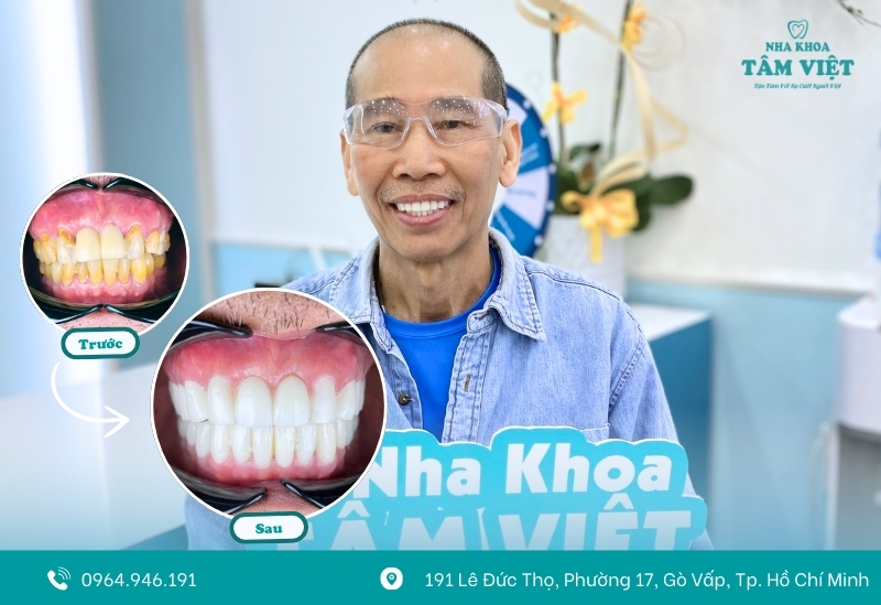 Đâu là nha khoa uy tín bọc răng sứ chất lượng gần bạn nhất? 2 Thị trường nha khoa bọc răng sứ tại TPHCM