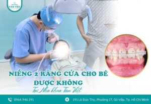 Niềng 2 răng cửa cho bé được không? Giá bao nhiêu?