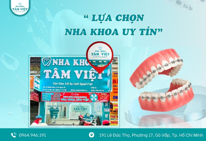 Có nên niềng răng cho bé 6 tuổi? Những điều cần lưu ý 5 Địa chỉ vàng chỉnh nha trẻ em tại Gò Vấp