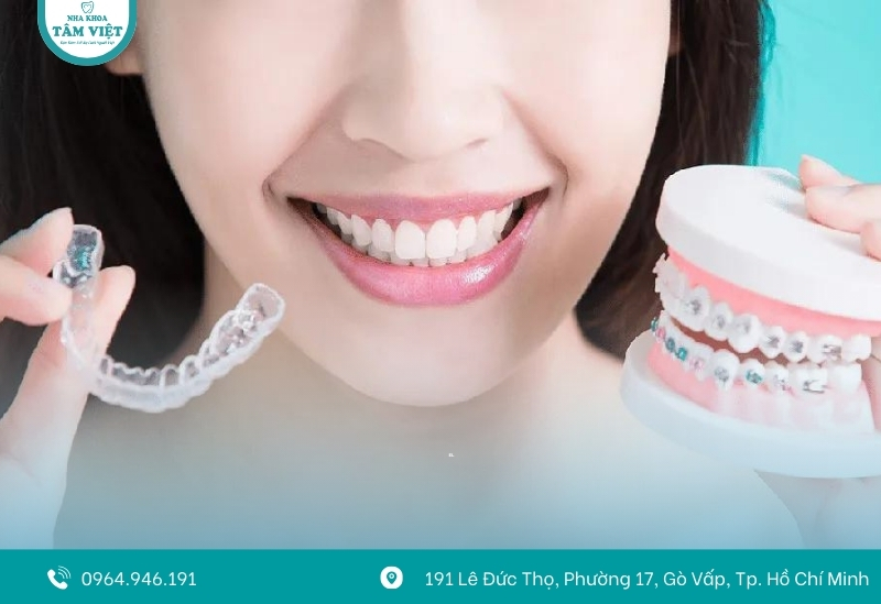 Niềng răng không mắc cài là gì? Có nên làm không? 2 So sánh với niềng răng mắc cài truyền thống