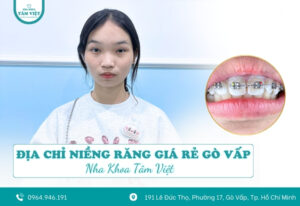 Niềng răng móm giá rẻ có thật sự an toàn như quảng cáo?