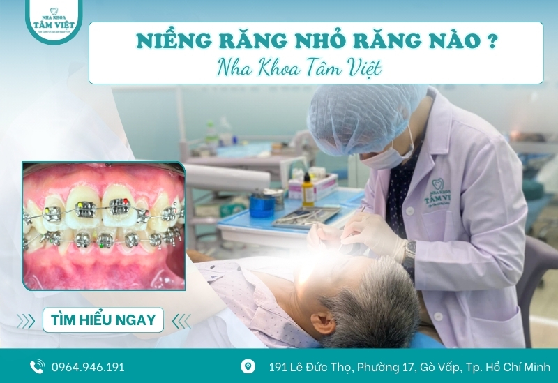 Niềng răng nhổ răng nào an toàn, hiệu quả nhất