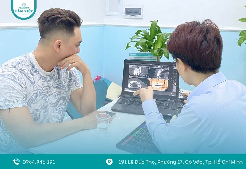 So sánh giữa răng Implant và răng thật: Có nên làm? 4 Khi nào nên cân nhắc trồng răng Implant?