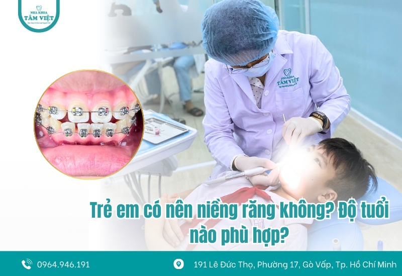 Trẻ em có nên niềng răng không? Độ tuổi nào phù hợp?