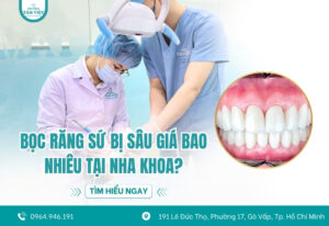 Bọc răng sứ bị sâu giá bao nhiêu tại nha khoa? Có đắt không?
